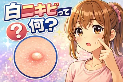 白ニキビって何？原因・治し方・悪化させないスキンケアのコツまでやさしく解説